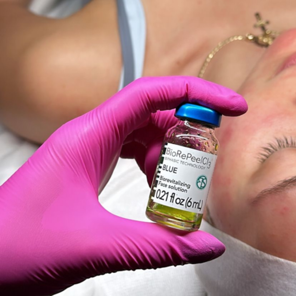 BioRePeel 4 Pack at BEAM LASER STUDIO in Plymouth, MI