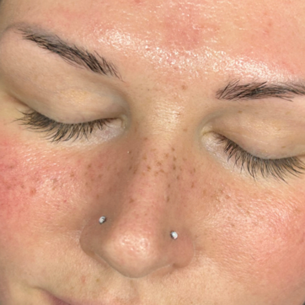 Medium Coverage Freckle Tattoo at Lemon Lash @ FaceFrame Collective in Pittsfield, MA