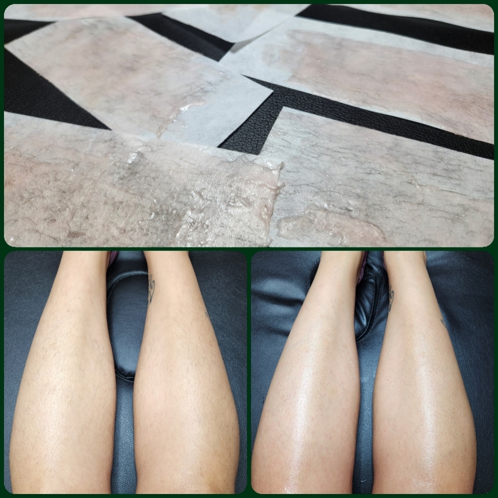 Legs at Evermore Esthetics in Gravette, AR