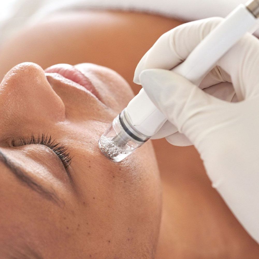 Diamond Tip Facial