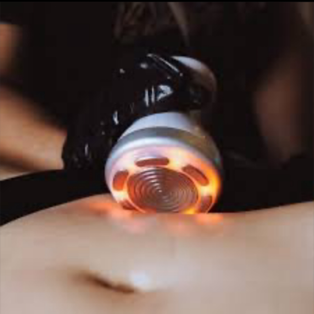 Full Body Sculpt at Body Spa MKE LLC in West Allis, WI