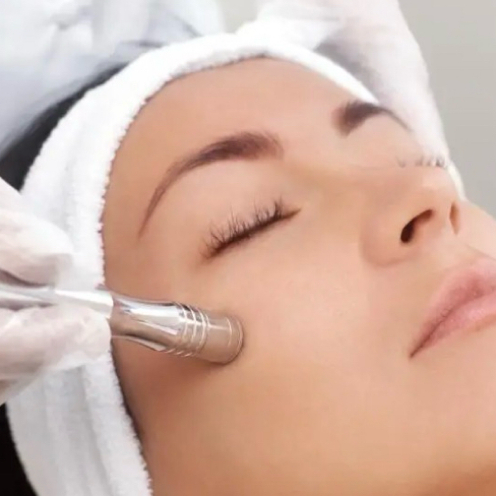 Microderm GLOW Treatment at RjM Skin in Cutler Bay, FL