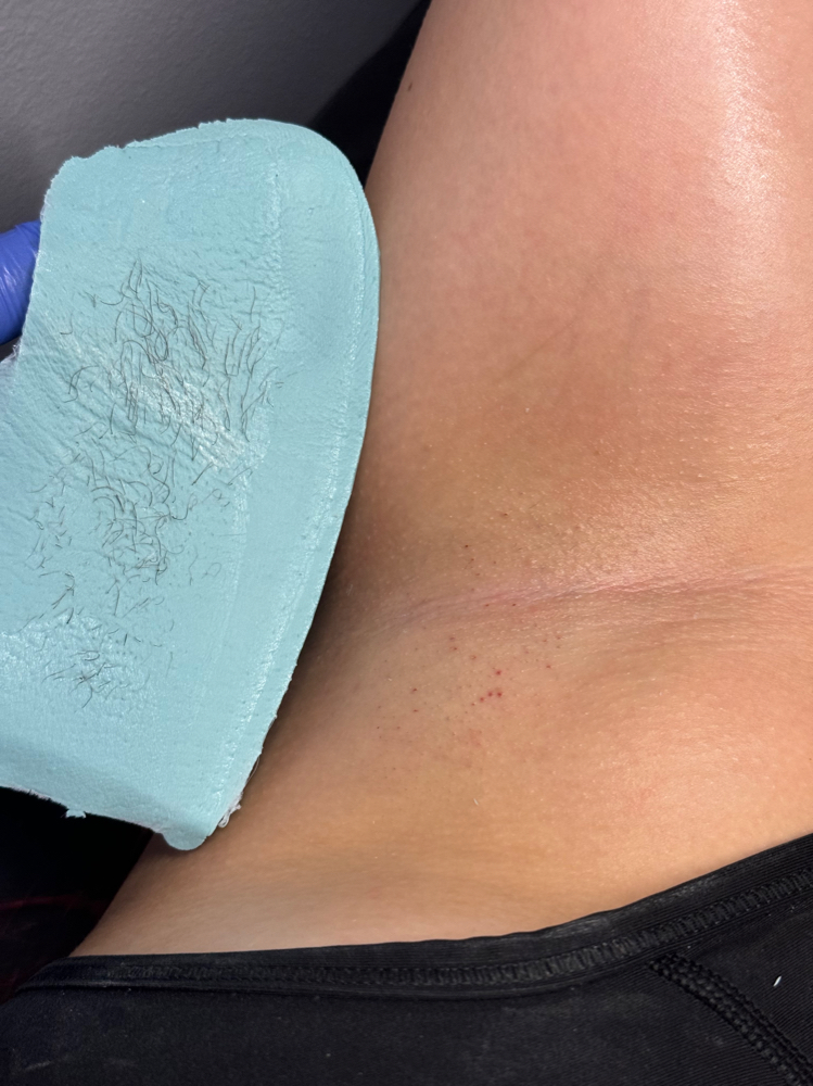 Underarm Wax at Moonlight Aesthetics in pensacola, FL