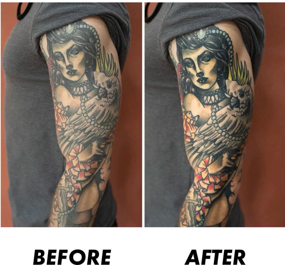 Tattoo Rejuvenation (Sleeve)