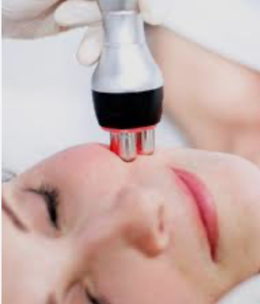 Radiofrequency Facial
