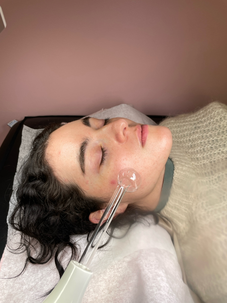 Add On High frequency 10 Min