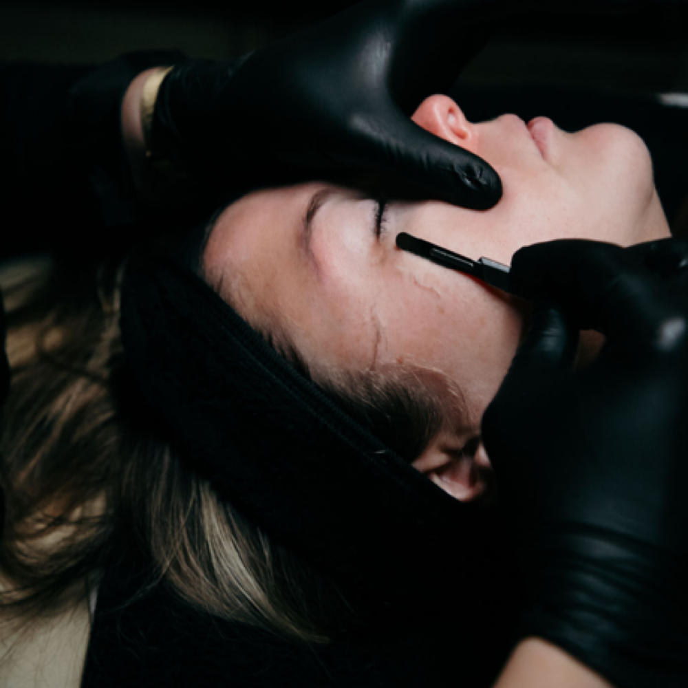 Dermaplane at Reese SkinTreat in Cape Girardeau, MO