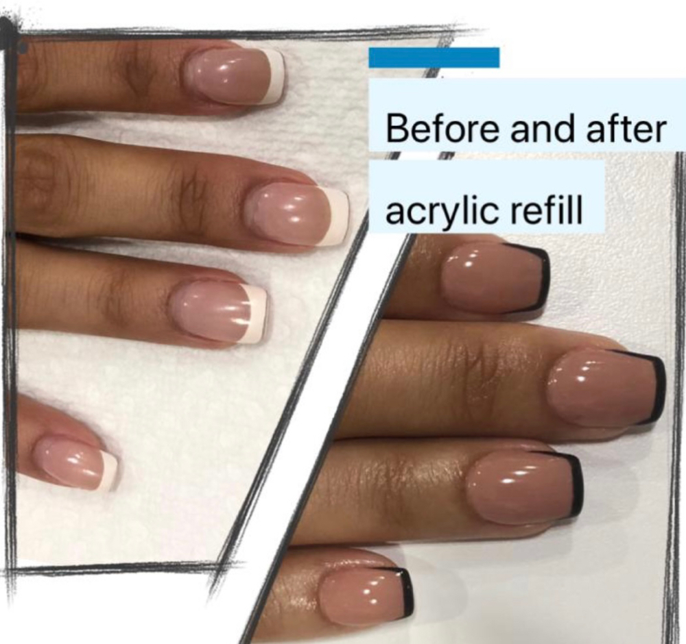 Nail-Refill Or Fill-In (Handset)