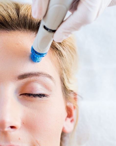 Hydroluxx Hydrodermabrasion Facial