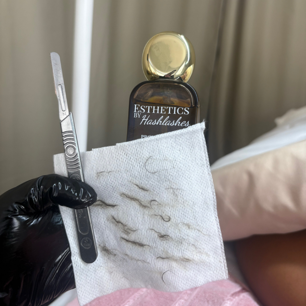 Dermaplaning at Izsthetics in Haverstraw, NY