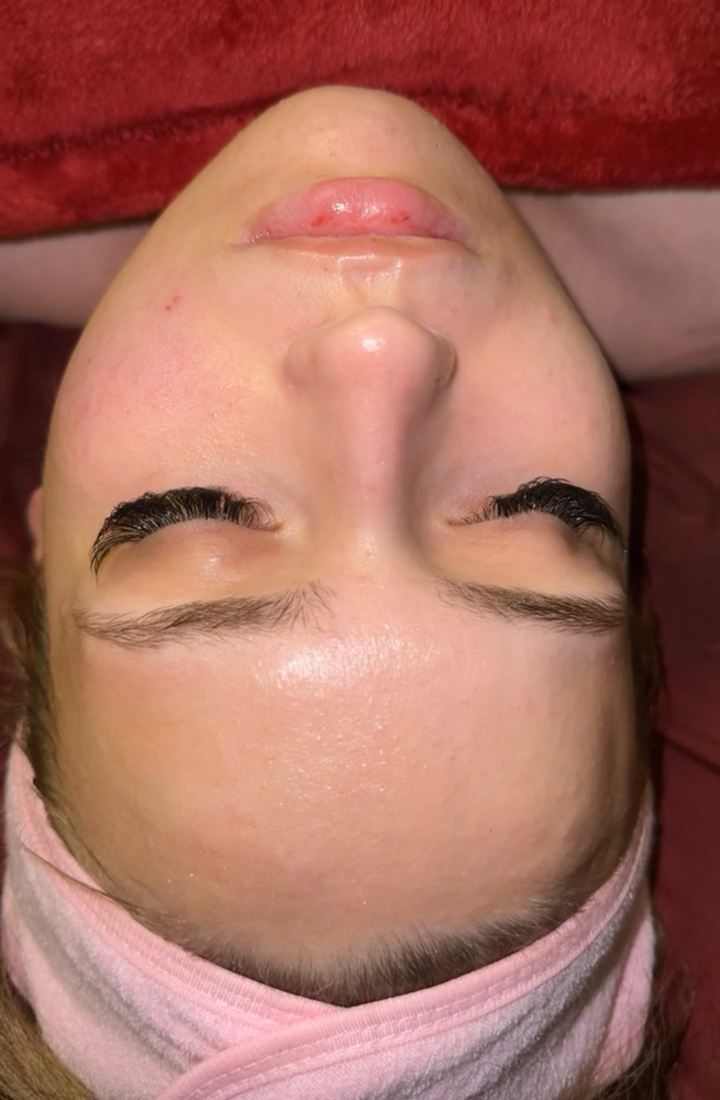 Full Facial Treatment