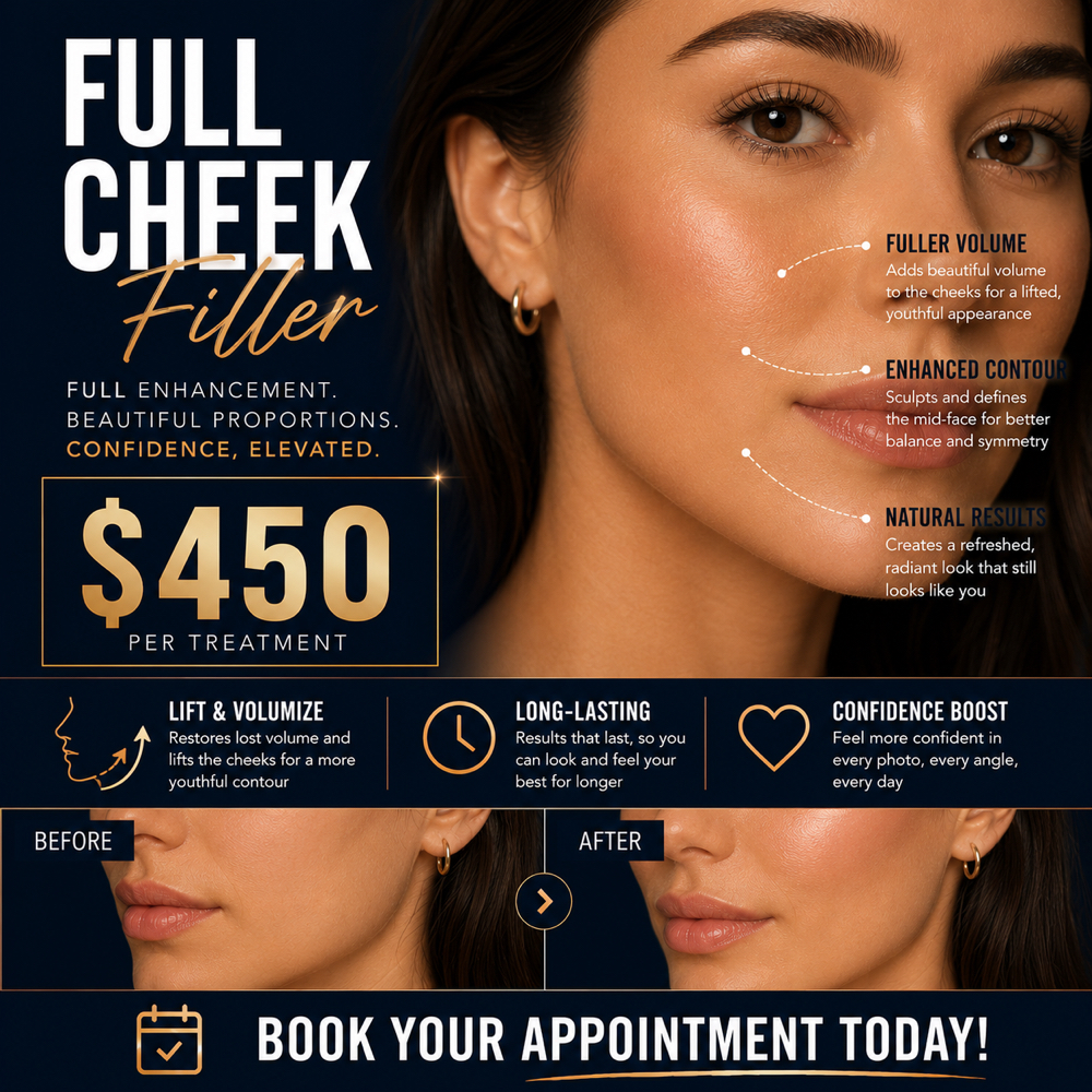 FULL CHEEK FILL at RGV PRIME AESTHETICS PLLC in Mcallen, TX