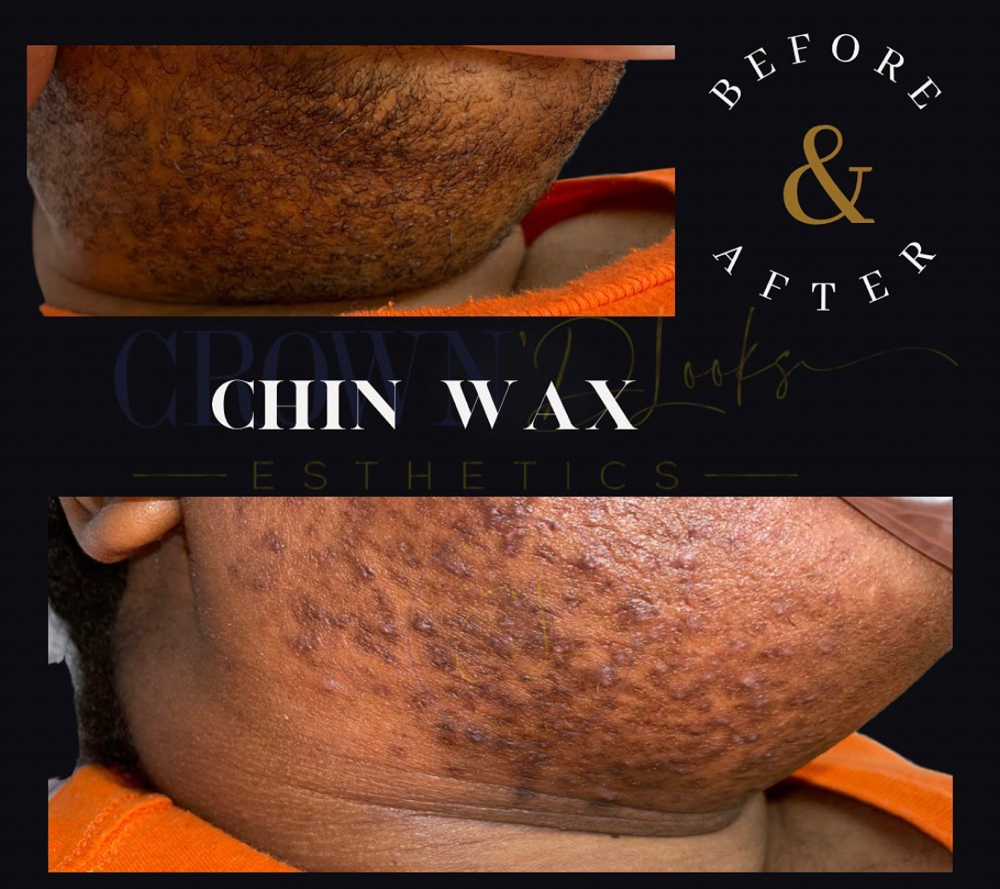 Chin Wax