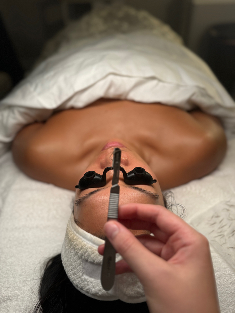 Dermaplane Facial