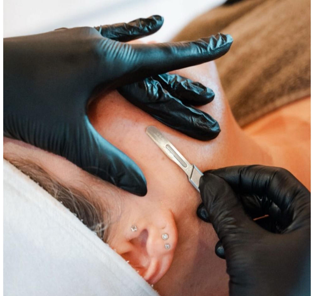 Dermaplaning ADD ON ONLY