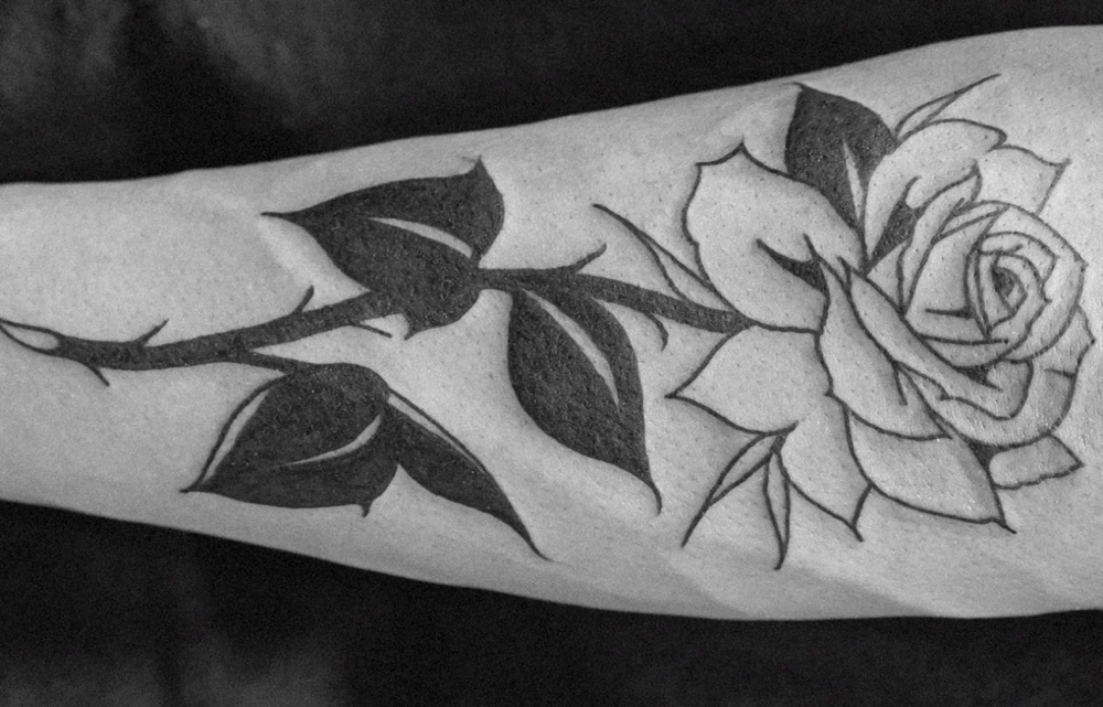 Tattoo Rejuvenation (Forearm)