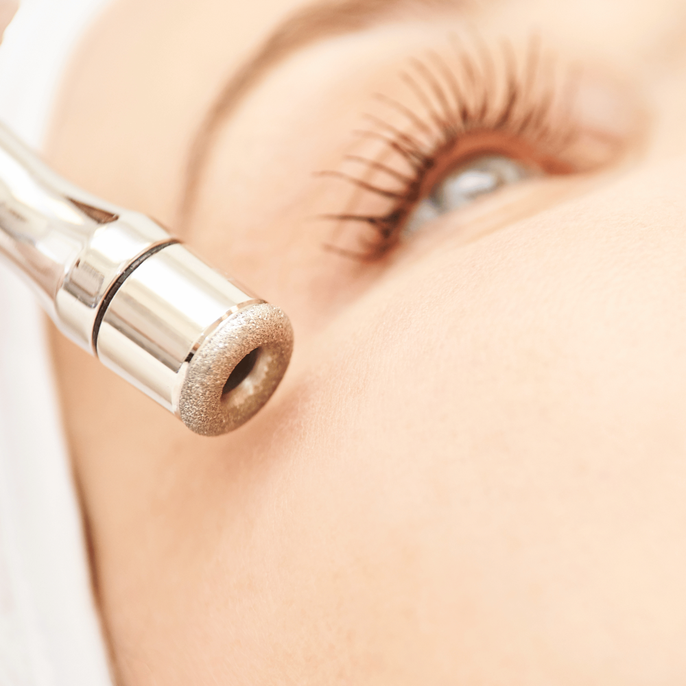 Microdermabrasion Facial
