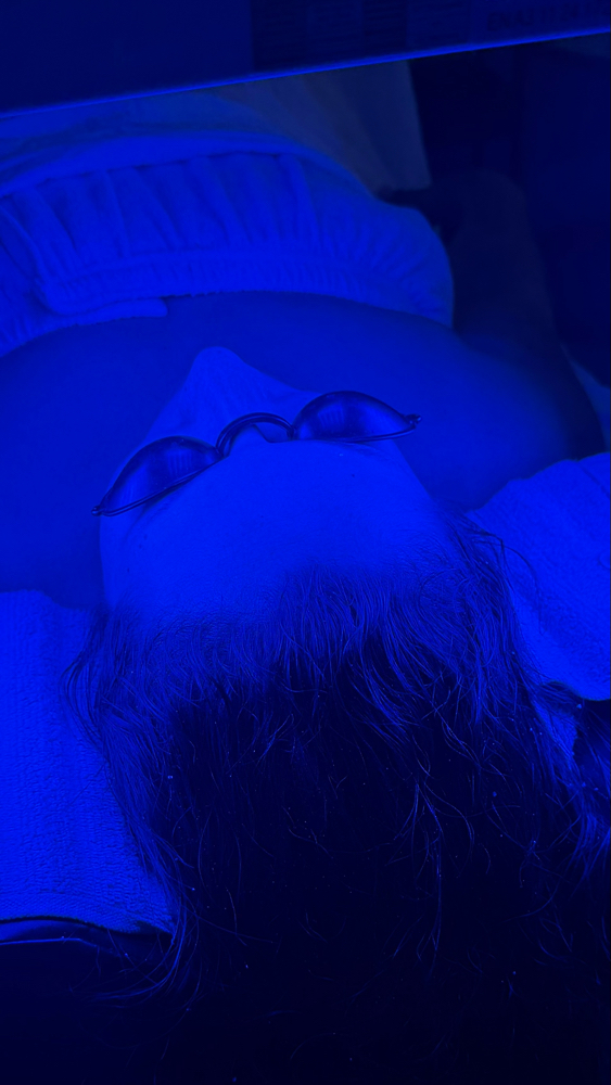 LED Photo Facial