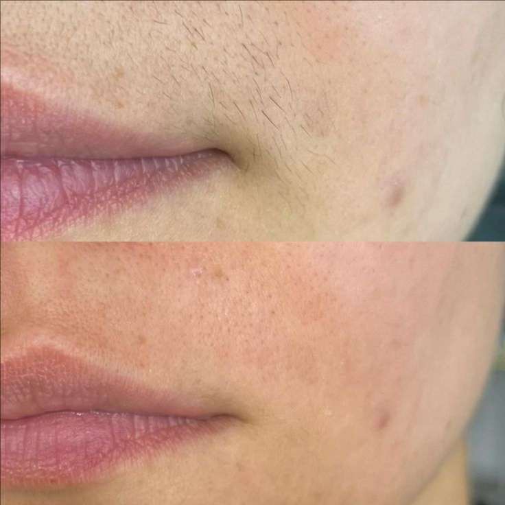 Upper Lip Wax at VeleaRaeStudio in Tempe, AZ