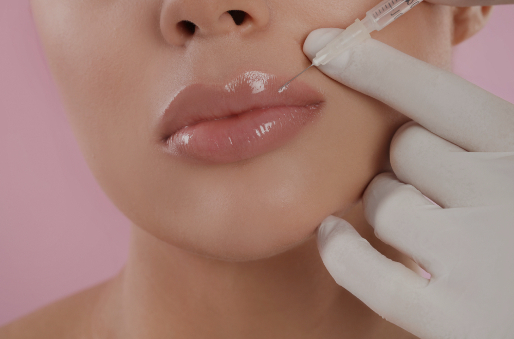 Dermal Filler at The Virtuous Glow in Roswell, NM