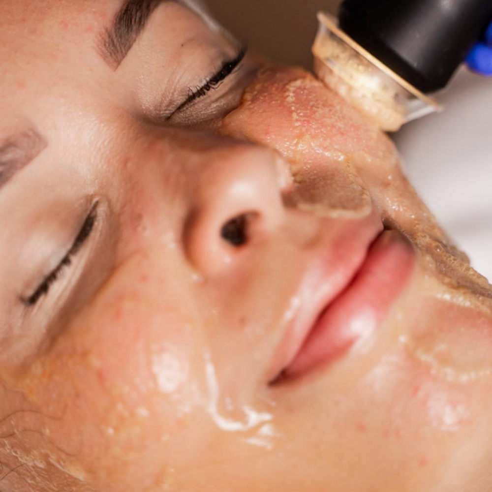 Oxfoliation Facial at Wicked Nails & Skin in San Antonio, TX