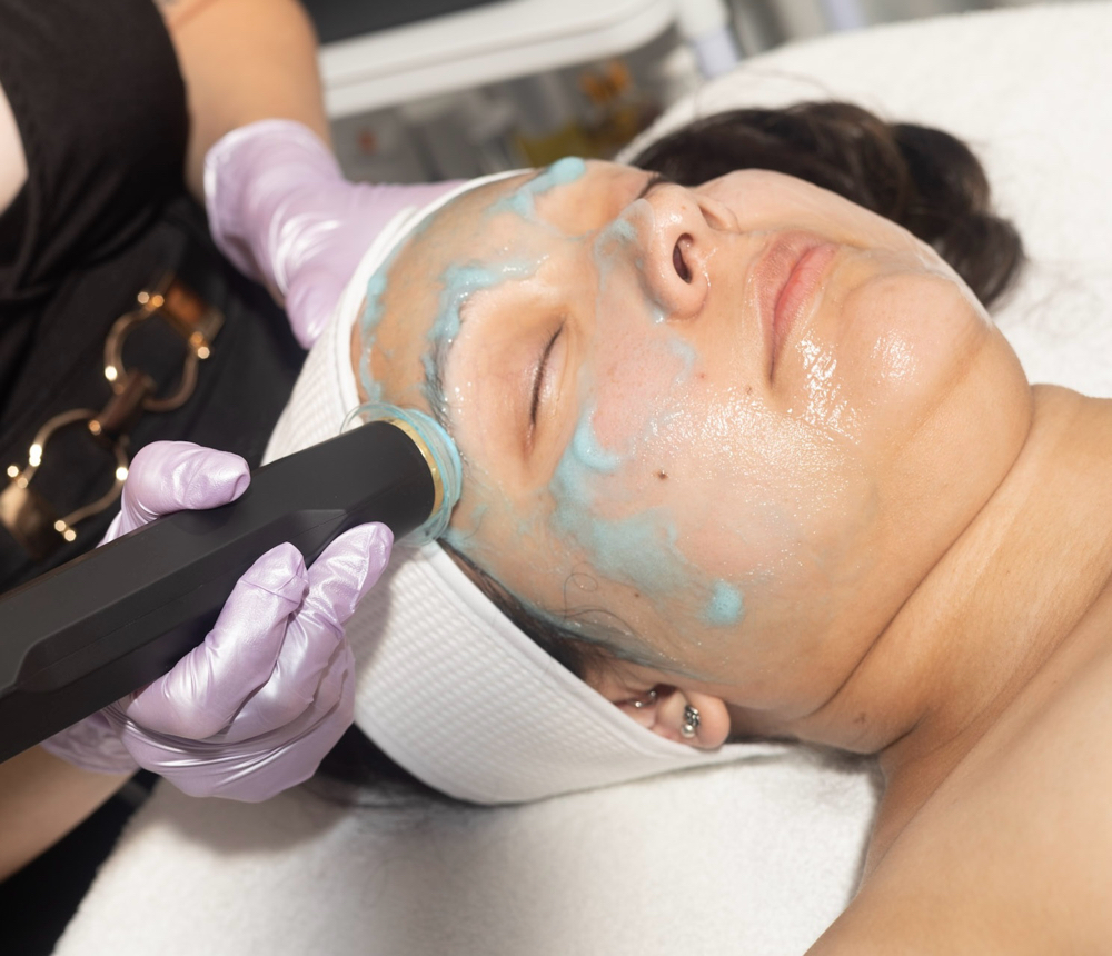 Oxfoliation Facial