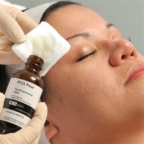 PCA Professional Peel Treatment