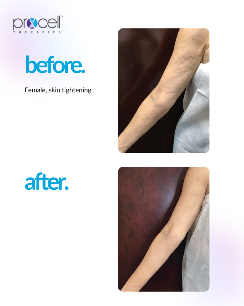 Procell Body Renewal