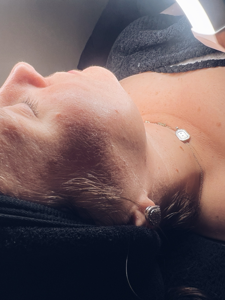 Dermaplane Facial