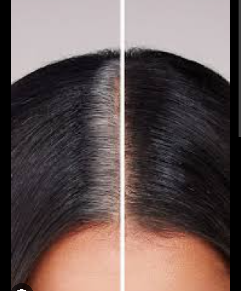 Root touch up
