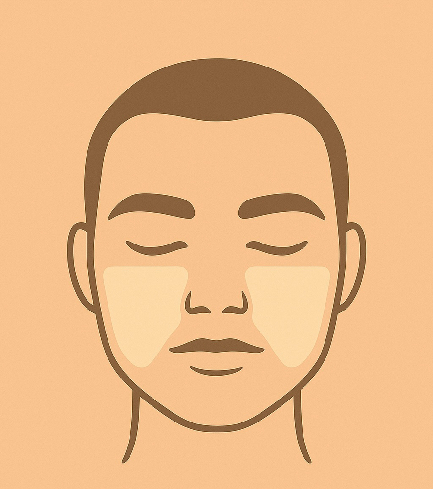 Cheeks at BareSkinAesthetics in Ridgeland, MS