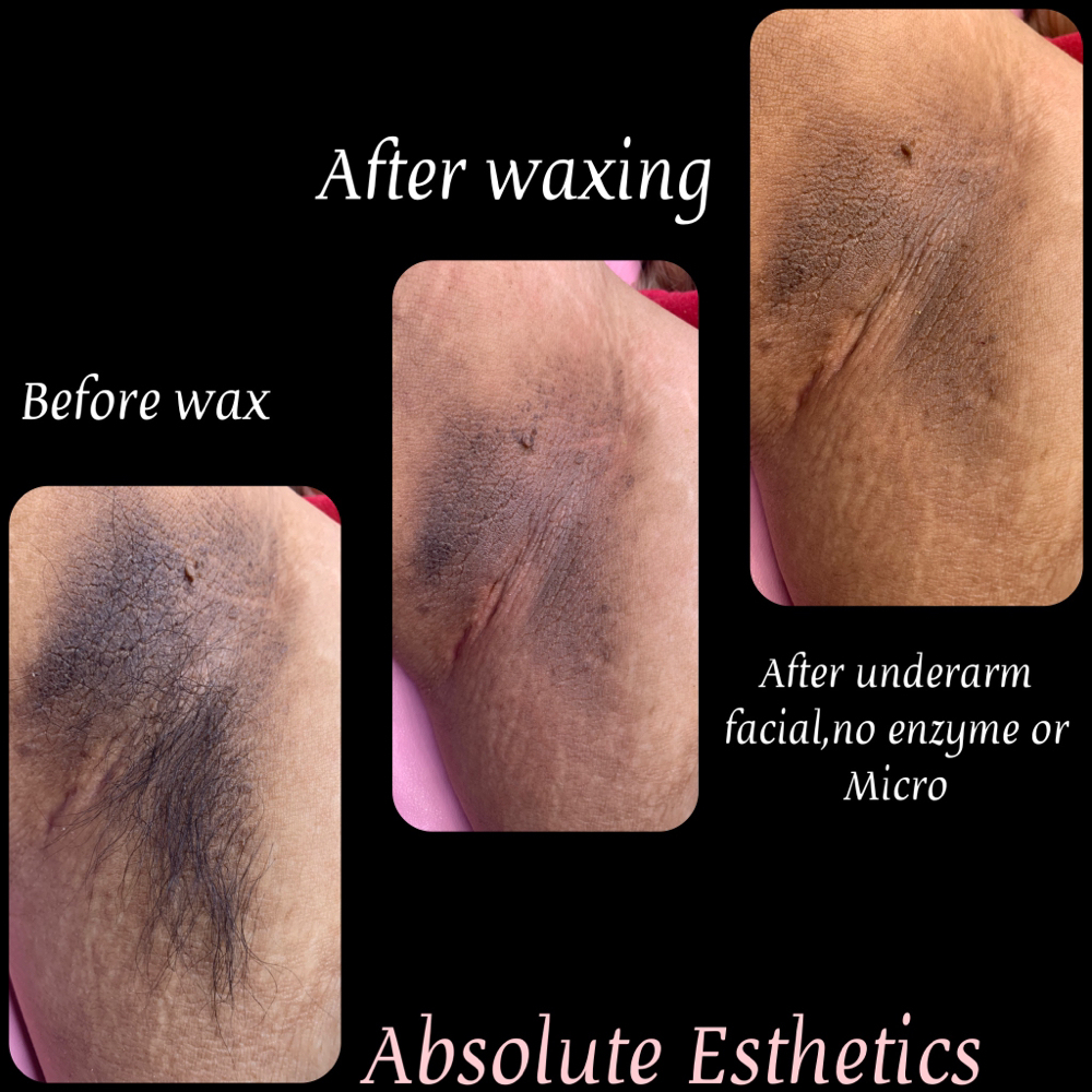 Under Arm Lightening