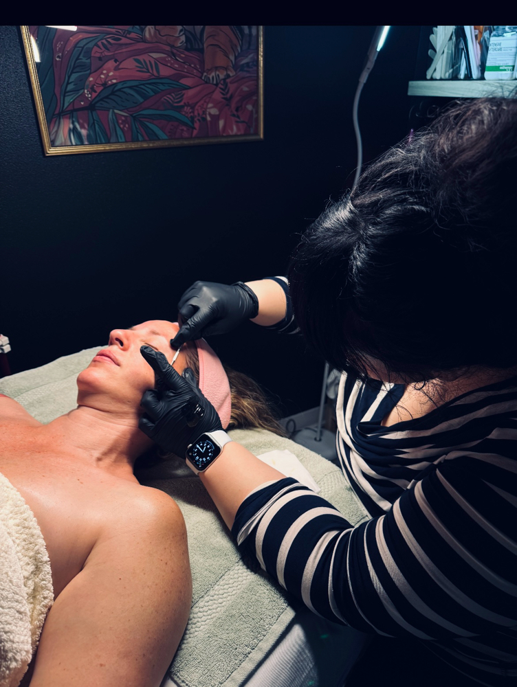The Dermaplane Facial