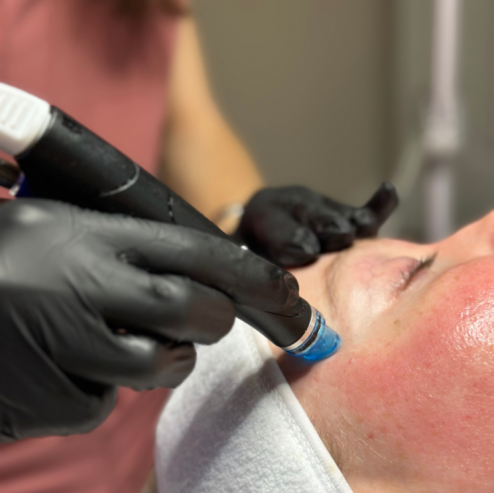 Hydrafacial at Endless Summer Spray Tan and Waxing in Georgetown, TX
