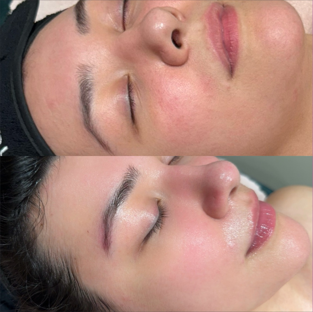 Korean Glass Skin Facial