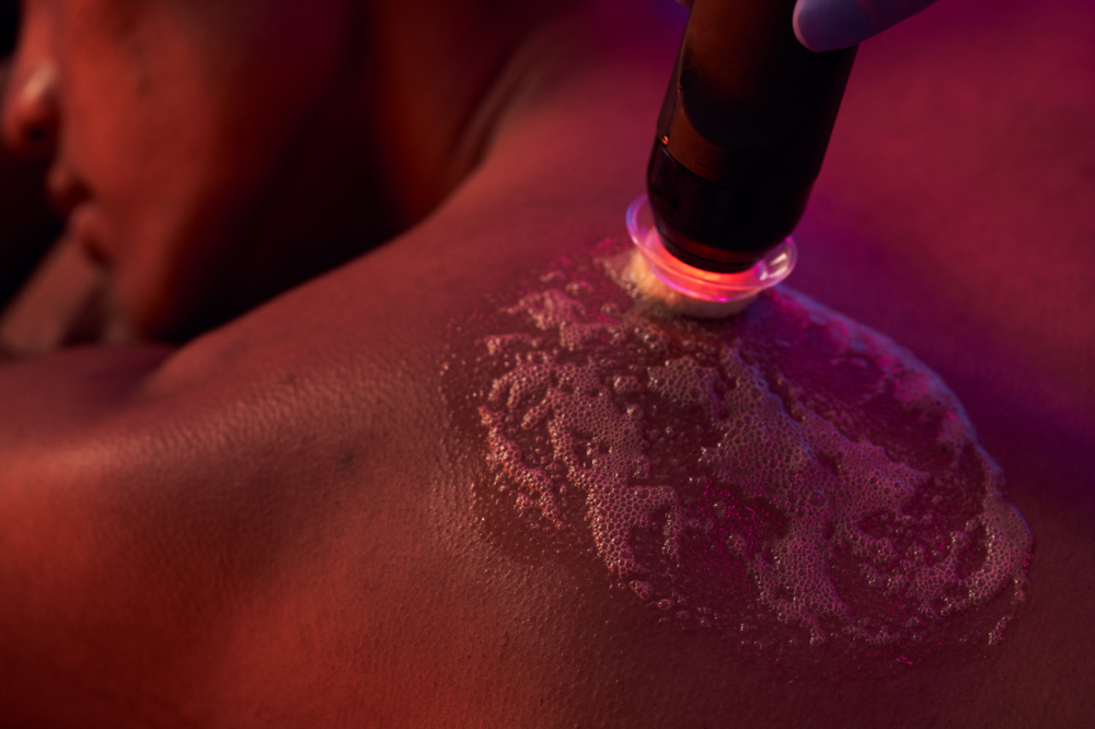 Upper Back Glo2Facial