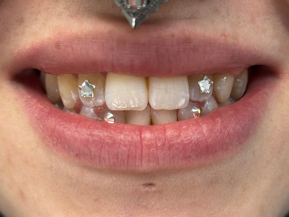 Additional Micro/Shaped Crystal