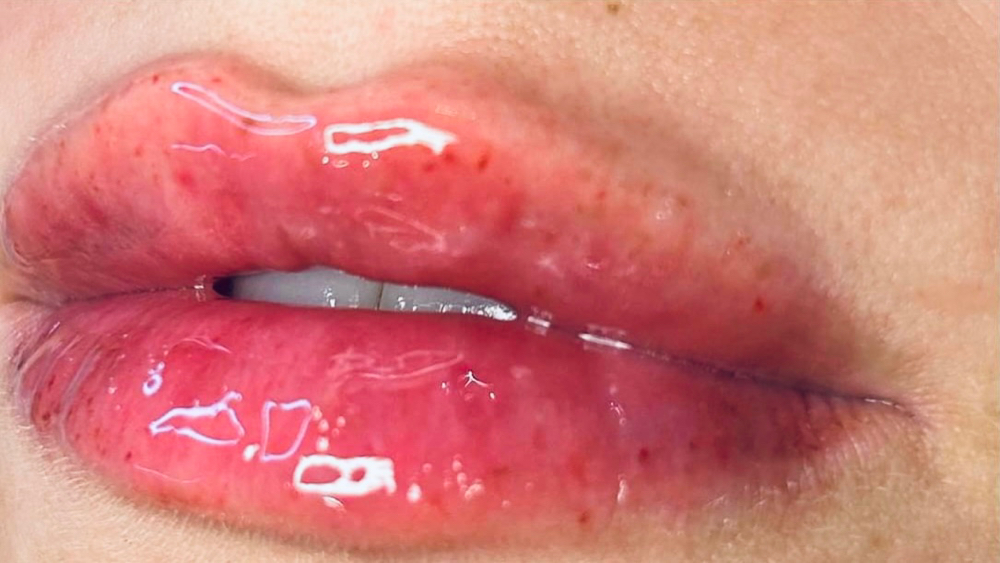 Hya Lips