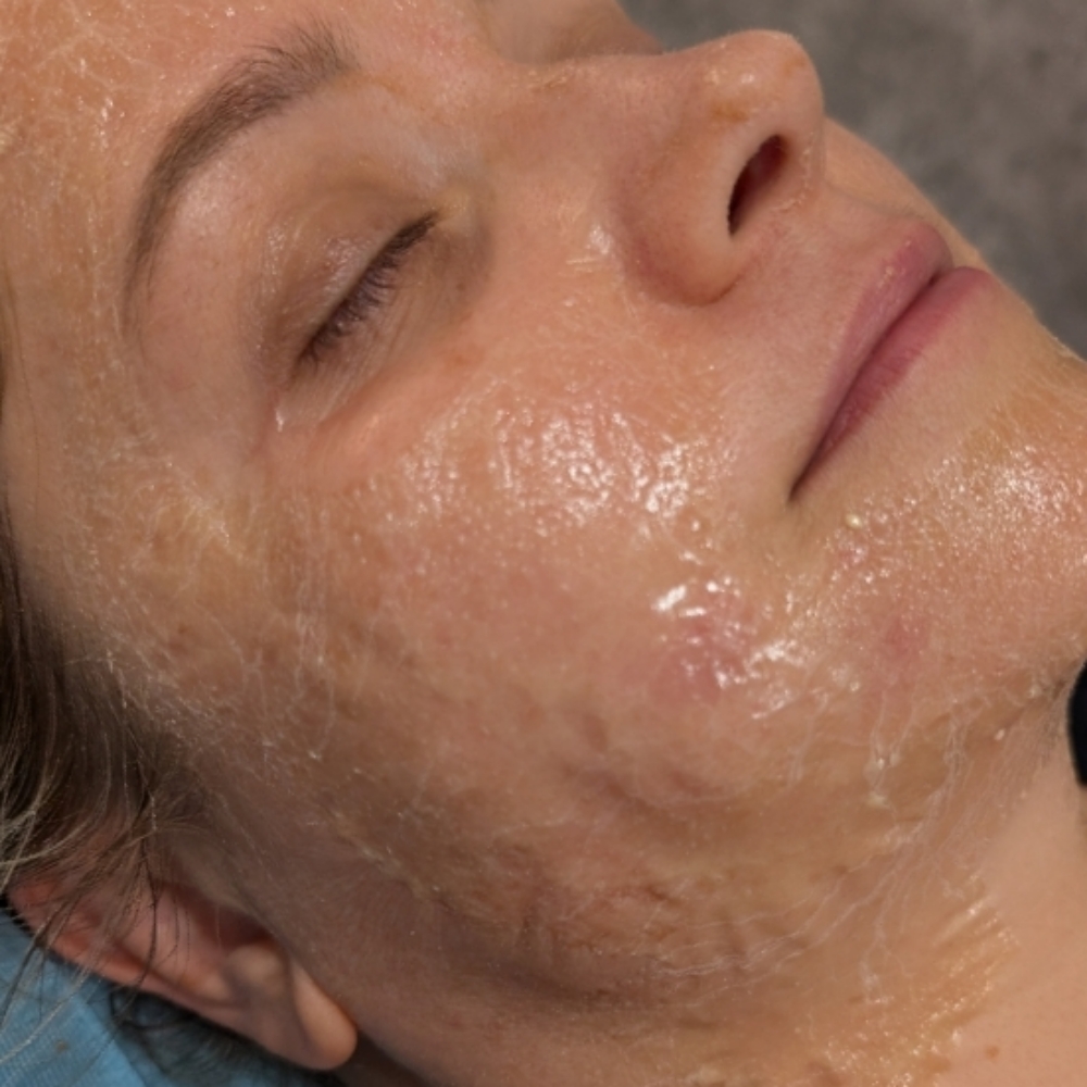 Circiada Luxury Lift Facial at Yesskin Skin Care in Tarpon Springs, FL