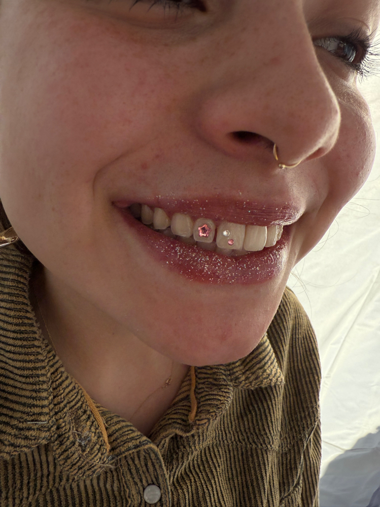 3-5 Tooth Gems