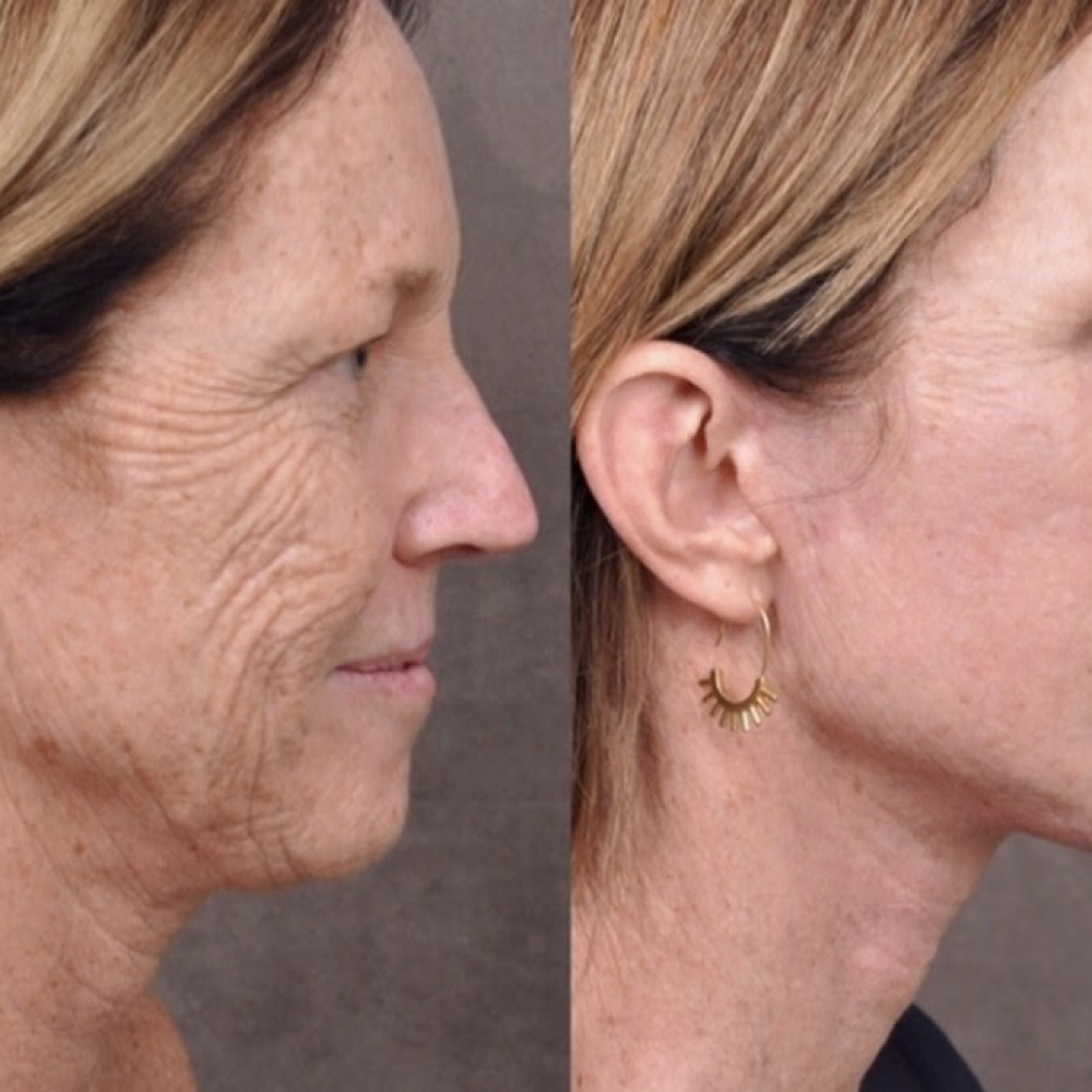 Matrix Pro at Bloom Beauty Lab in Upland, CA