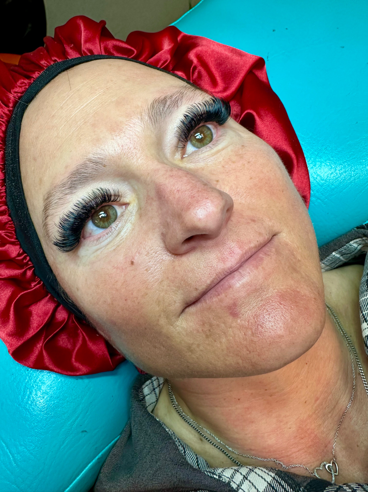 New Client (Extended) Mega-V Fill