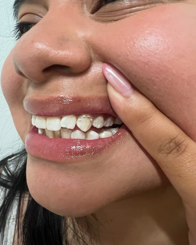 DIY Tooth Gem Kits