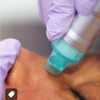 Ares Advanced Hydroderm (75 Min) at MUSE Beauty Lounge in Taylor, TX