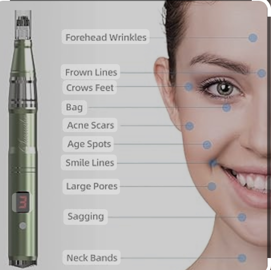 Microneedling