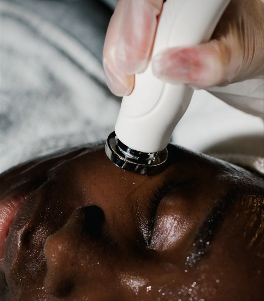 Radio Frequency Facial