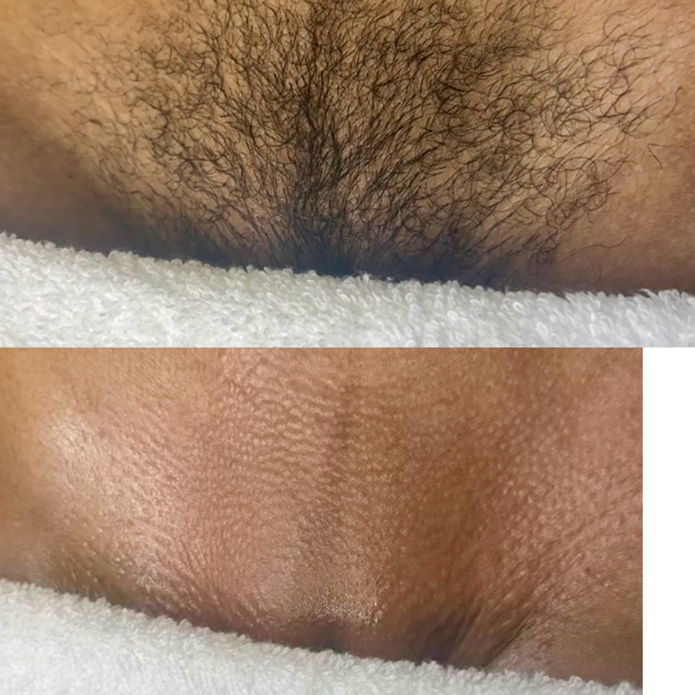 Waxing Services at KissMyLash Luxury Esthetics in Mayfield Heights, OH