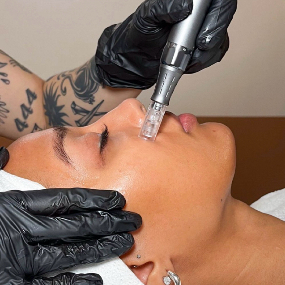 Cosmetic Microneedling