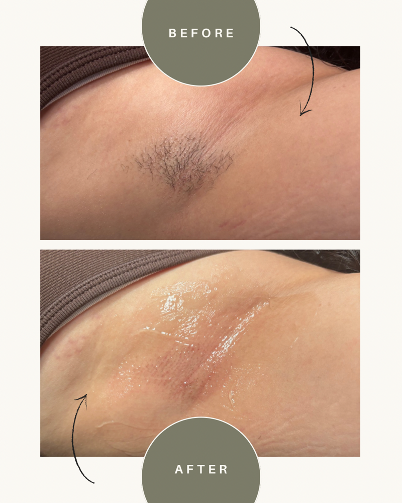 Arm Wax