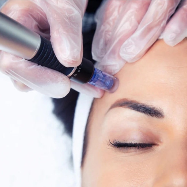 Hydro Facial + Microneedling at Skin Boutique Miami in South Miami, FL